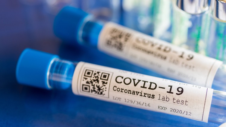 Umfrage zu Coronavirus: Autohandel rechnet mit Umsatzeinbußen
